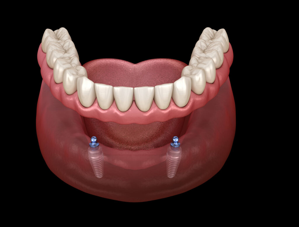 Istock 11497100031 Scaled.jpg